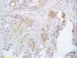 FUT8 Antibody in Immunohistochemistry (Paraffin) (IHC (P))