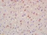BRD8 Antibody in Immunohistochemistry (Paraffin) (IHC (P))