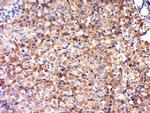 OVCA2 Antibody in Immunohistochemistry (Paraffin) (IHC (P))