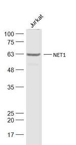 NET1 Antibody in Western Blot (WB)