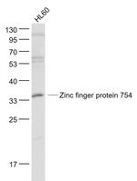 Zinc finger protein 754 Antibody in Western Blot (WB)