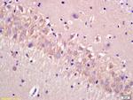 CECR5 Antibody in Immunohistochemistry (Paraffin) (IHC (P))