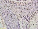Phospho-CDK5 (Tyr15) Antibody in Immunohistochemistry (Paraffin) (IHC (P))