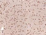 Phospho-PP2A alpha/beta (Tyr307) Antibody in Immunohistochemistry (Paraffin) (IHC (P))