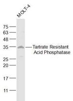 ACP5 Antibody in Western Blot (WB)