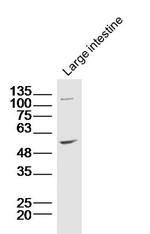 ZnT-1 Antibody in Western Blot (WB)