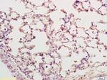 PEN2 Antibody in Immunohistochemistry (Paraffin) (IHC (P))