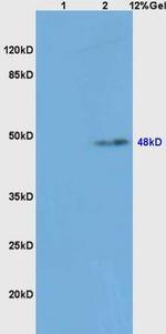 Caspase-8 subunit p18 Antibody in Western Blot (WB)