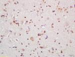 IRAK1 Antibody in Immunohistochemistry (Paraffin) (IHC (P))