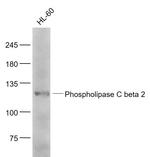Phospholipase C beta 2 Antibody in Western Blot (WB)