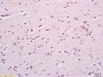 CKAP4 Antibody in Immunohistochemistry (Paraffin) (IHC (P))