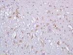 Clavesin Antibody in Immunohistochemistry (Paraffin) (IHC (P))