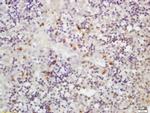 Clavesin Antibody in Immunohistochemistry (Paraffin) (IHC (P))