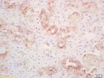 PLRP1 Antibody in Immunohistochemistry (Paraffin) (IHC (P))