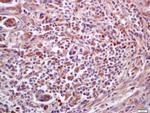 PPT1 Antibody in Immunohistochemistry (Paraffin) (IHC (P))