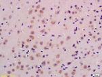PPT1 Antibody in Immunohistochemistry (Paraffin) (IHC (P))