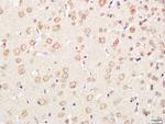 XPC Antibody in Immunohistochemistry (Paraffin) (IHC (P))