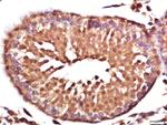 Vinculin Antibody in Immunohistochemistry (Paraffin) (IHC (P))