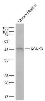 KCNK3 Antibody in Western Blot (WB)