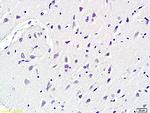 KCNN4 Antibody in Immunohistochemistry (Paraffin) (IHC (P))