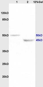KCNN4 Antibody in Western Blot (WB)