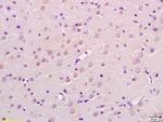 AP2 gamma Antibody in Immunohistochemistry (Paraffin) (IHC (P))