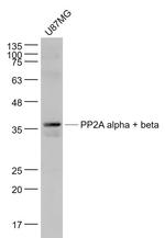 PP2A beta Antibody in Western Blot (WB)