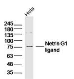 Netrin G1 ligand Antibody in Western Blot (WB)