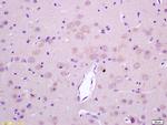 LGI1 Antibody in Immunohistochemistry (Paraffin) (IHC (P))