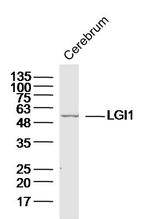 LGI1 Antibody in Western Blot (WB)