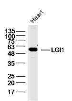 LGI1 Antibody in Western Blot (WB)