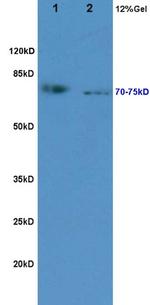 KIRREL2 Antibody in Western Blot (WB)