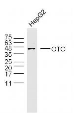 OTC Antibody in Western Blot (WB)