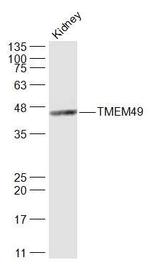 TMEM49 Antibody in Western Blot (WB)