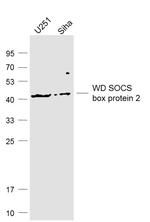 WD SOCS box protein 2 Antibody in Western Blot (WB)