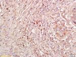 IL-10 Antibody in Immunohistochemistry (Paraffin) (IHC (P))