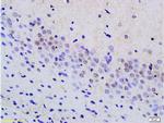 Phospho-MAP3K9 (Thr312) Antibody in Immunohistochemistry (Paraffin) (IHC (P))