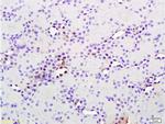 Phospho-MAP3K9 (Thr312) Antibody in Immunohistochemistry (Paraffin) (IHC (P))