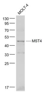 STK26 Antibody in Western Blot (WB)