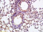 APPD Antibody in Immunohistochemistry (Paraffin) (IHC (P))