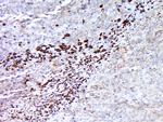 MAGEA5 Antibody in Immunohistochemistry (Paraffin) (IHC (P))