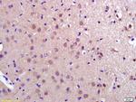 PDCD10 Antibody in Immunohistochemistry (Paraffin) (IHC (P))