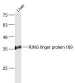 RING finger protein 189 Antibody in Western Blot (WB)