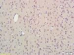 SCN3B Antibody in Immunohistochemistry (Paraffin) (IHC (P))