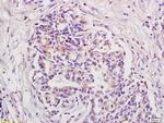 BOD1 Antibody in Immunohistochemistry (Paraffin) (IHC (P))