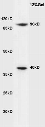 Cyclin M2 Antibody in Western Blot (WB)
