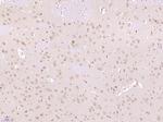 FRS2 Antibody in Immunohistochemistry (Paraffin) (IHC (P))