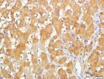 CCDC69 Antibody in Immunohistochemistry (Paraffin) (IHC (P))
