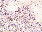 SEMA4D Antibody in Immunohistochemistry (Paraffin) (IHC (P))