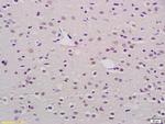 Mkl1 Antibody in Immunohistochemistry (Paraffin) (IHC (P))